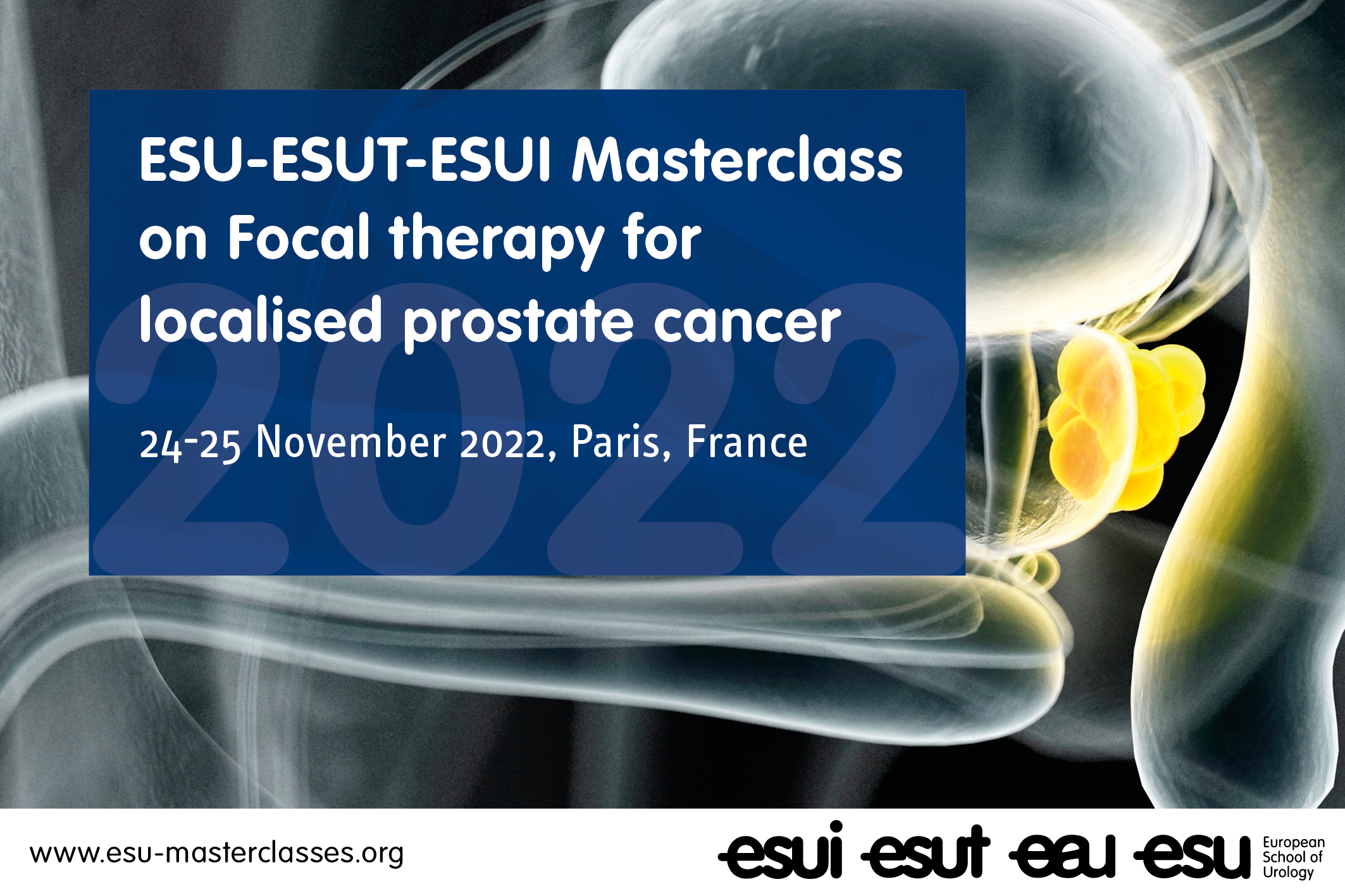 ESU-ESUT-ESUI Masterclass on Focal therapy for localised prostate cancer