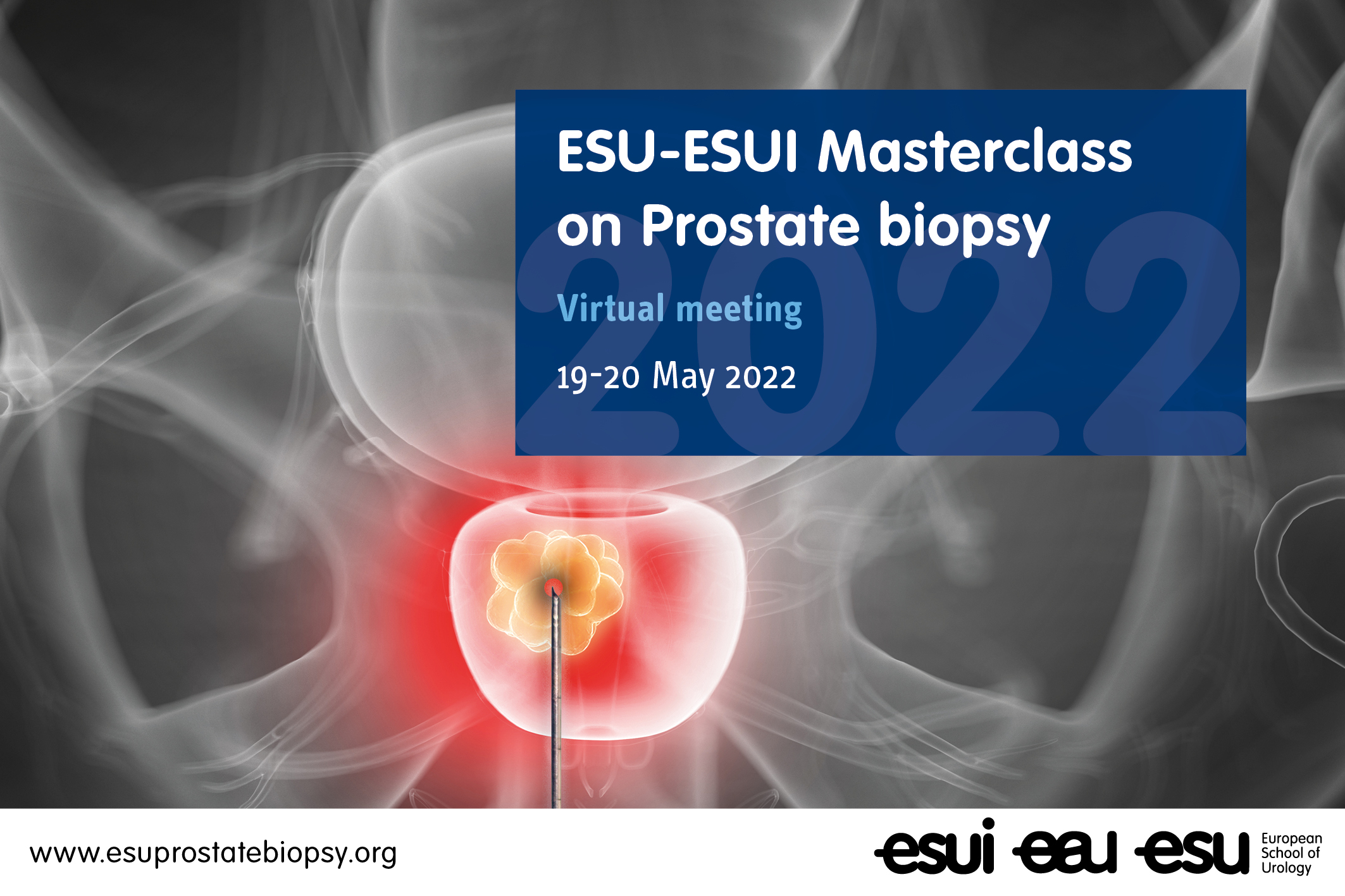 ESU-ESUI masterclass on prostate biopsy