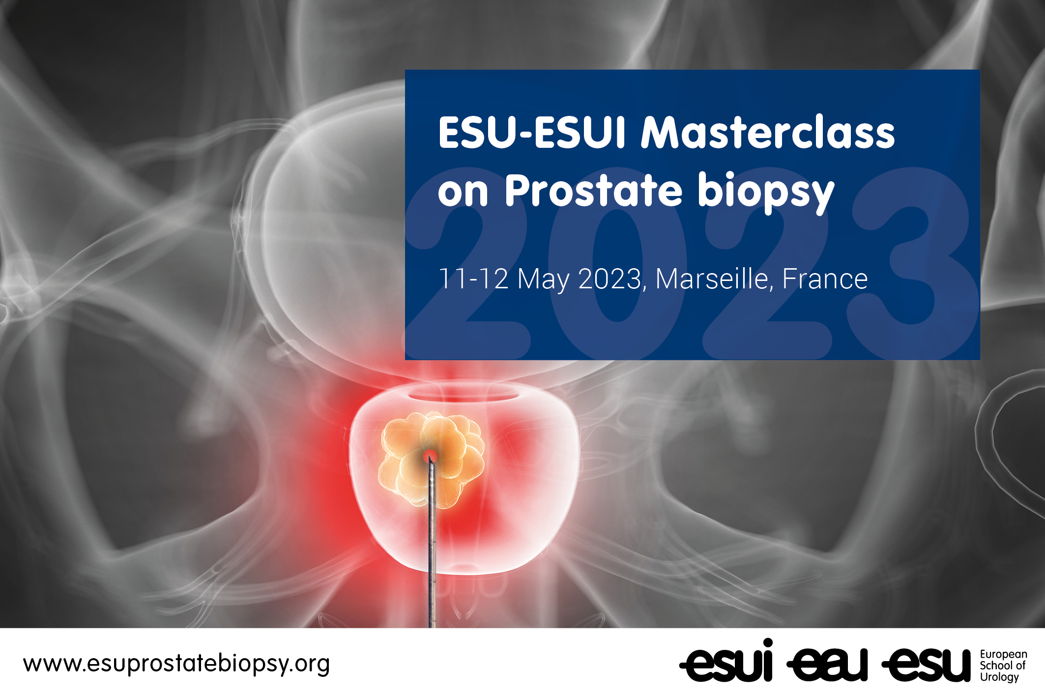 ESU-ESUI Masterclass on Prostate biopsy