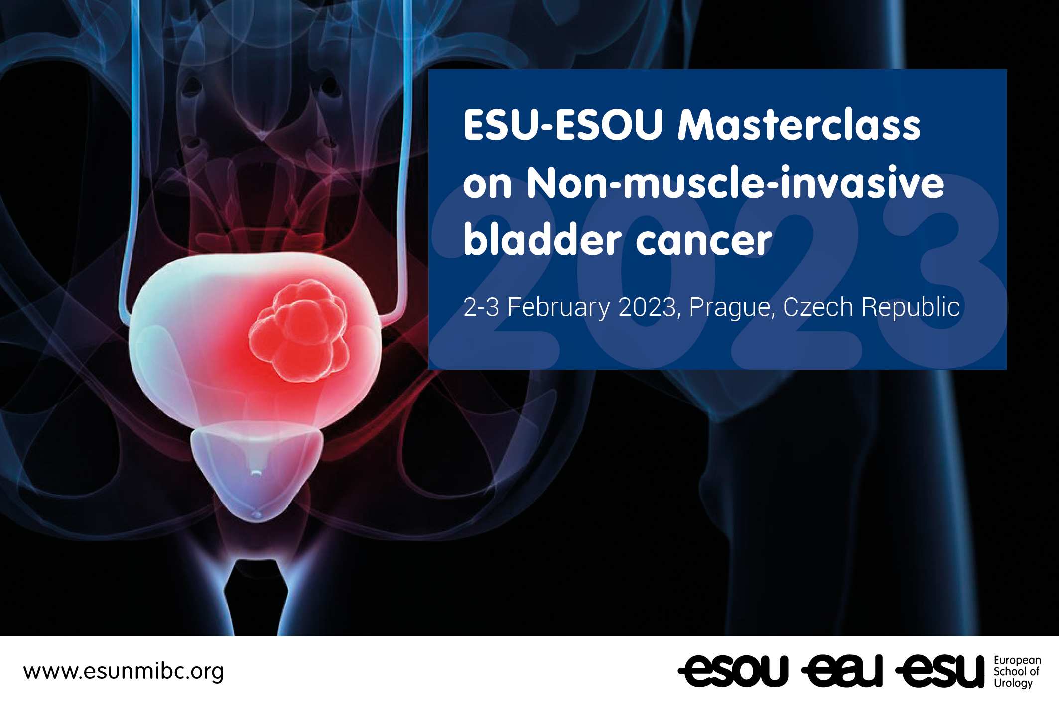 ESU-ESOU Masterclass on Non-muscle-invasive bladder cancer
