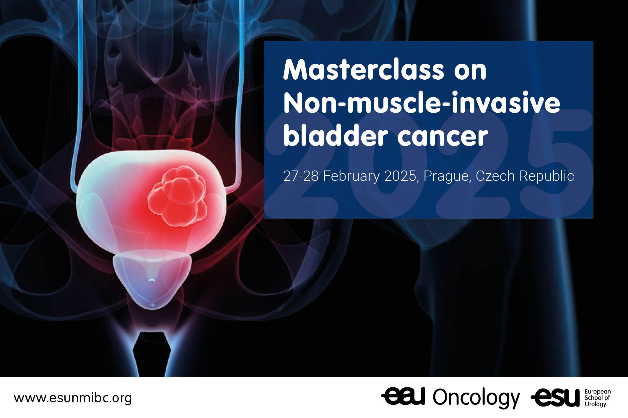 Masterclass on Non-muscle-invasive bladder cancer