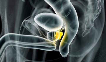 4th ESU-ESUT-ESUI masterclass on focal therapy for localised prostate cancer