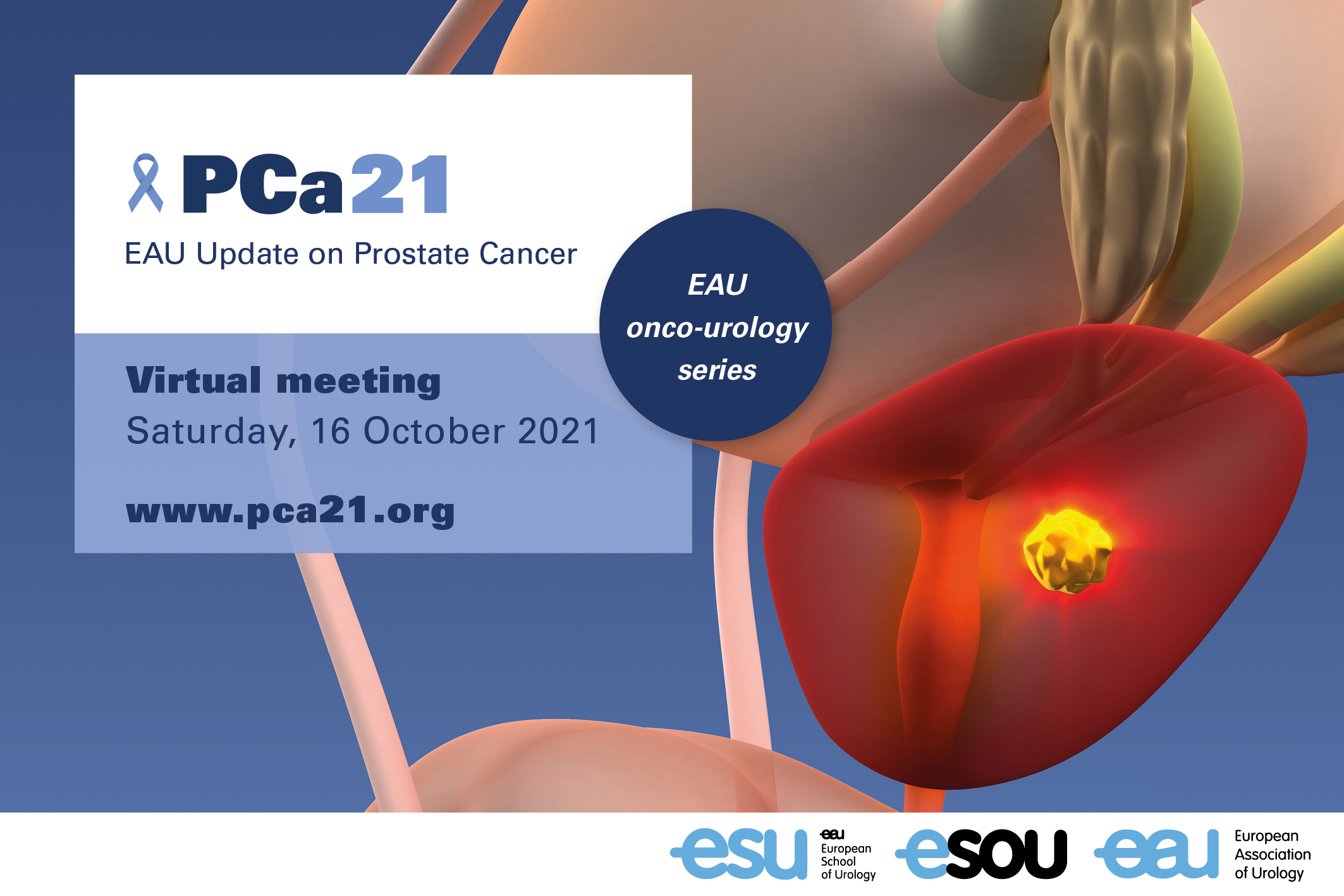 EAU Update on Prostate Cancer - PCa21